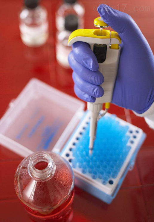 Human Angiopoietin-1 EasyTestTM  ELISA kit